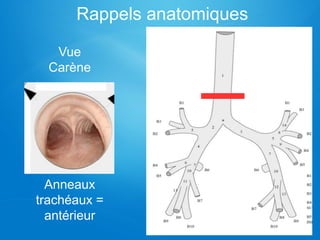 Rappels anatomiques
Vue
Carène
Anneaux
trachéaux =
antérieur
 