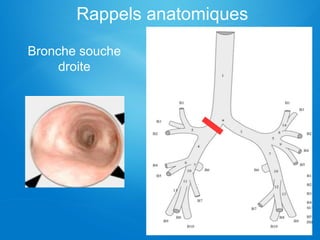 Rappels anatomiques
Bronche souche
droite
 