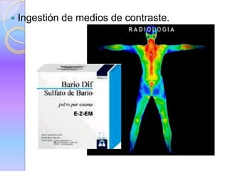  Ingestión de medios de contraste.