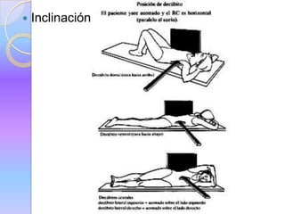  Inclinación.