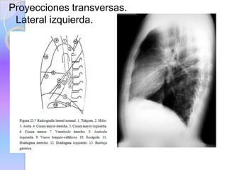 Proyecciones transversas.
Lateral izquierda.