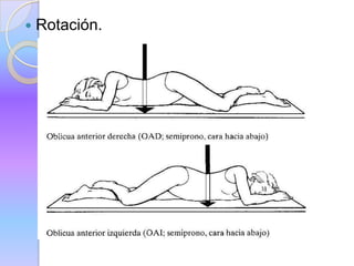  Rotación.