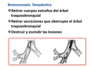 Retirar cuerpos extraños del árbol
traqueobronquial
Retirar secreciones que obstruyen el árbol
traqueobronquial
Destruir y escindir las lesiones
 