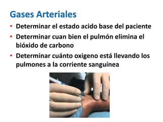 Gases Arteriales
• Determinar el estado acido base del paciente
• Determinar cuan bien el pulmón elimina el
bióxido de carbono
• Determinar cuánto oxigeno está llevando los
pulmones a la corriente sanguínea
 