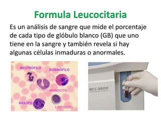 Formula Leucocitaria
Es un análisis de sangre que mide el porcentaje
de cada tipo de glóbulo blanco (GB) que uno
tiene en la sangre y también revela si hay
algunas células inmaduras o anormales.
 