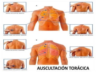 AUSCULTACIÓN TORÁCICA
 