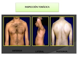 INSPECCIÓN TORÁCICA
 