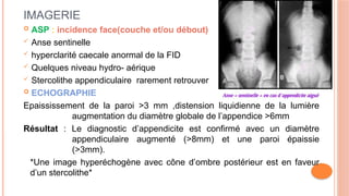Scanner Stercolithe EXPOSES SUR APPENDICITE AIGUE MS DIEUMERCI.pptx