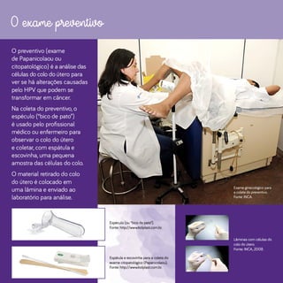 Exposicao digital inca_ca_colo_utero_2018