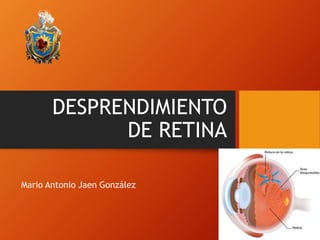DESPRENDIMIENTO 
DE RETINA 
Mario Antonio Jaen González 
 