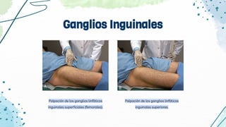 Ganglios Inguinales
Palpación de los ganglios linfáticos
inguinales superficiales (femorales).
Palpación de los ganglios linfáticos
inguinales superiores.
 