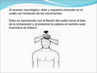 Al examen neurológico: dolor y espasmo muscular en el cuello con limitación de los movimientos. Dolor es reproducido con l...