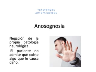 Anosognosia
Negación de la
propia patología
neurológica.
El paciente no
admite que existe
algo que le causa
daño.