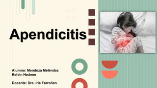 Apendicitis
Alumno: Mendoza Meléndez
Kelvin Hedmer
Docente: Dra. Iris Farroñan
 