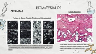 Biomateriales y Respuesta Inmune en Regeneración de Tejidos | PDF