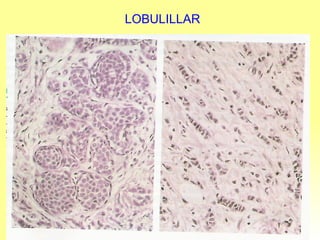 LOBULILLAR 