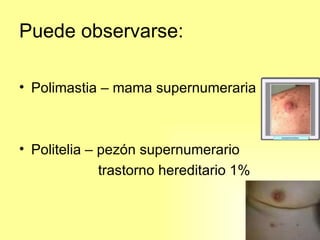 Puede observarse: Polimastia – mama supernumeraria Politelia – pezón supernumerario trastorno hereditario 1%  