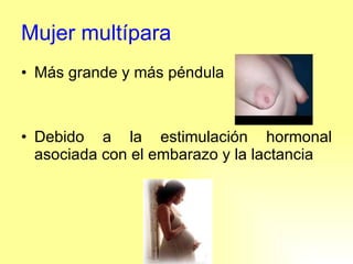 Mujer multípara Más grande y más péndula Debido a la estimulación hormonal asociada con el embarazo y la lactancia 