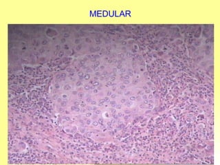 MEDULAR 