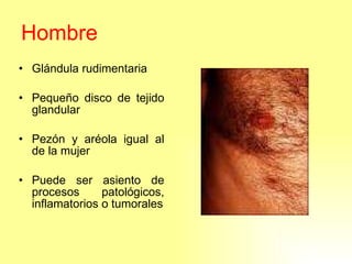 Hombre Glándula rudimentaria Pequeño disco de tejido glandular Pezón y aréola igual al de la mujer Puede ser asiento de procesos patológicos, inflamatorios o tumorales 