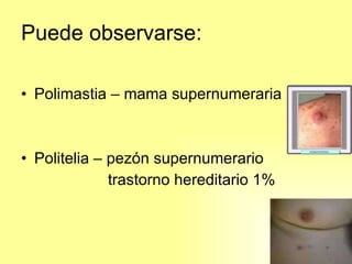 Puede observarse: Polimastia – mama supernumeraria Politelia – pezón supernumerario trastorno hereditario 1%  