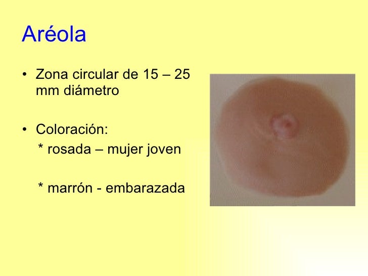 Reduccion De Areola Antes Y Despues ExposicióN Ca Mama