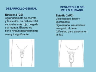 Estadio 2 (G2) 
Agrandamiento de escroto 
y testículos. La piel escrotal 
se vuelve más roja, delgada 
y arrugada. El pene no 
tiene ningún agrandamiento 
o muy insignificante. 
Estadio 2 (P2) 
Vello escaso, lacio y 
ligeramente 
pigmentado, usualmente 
arraigado al pene 
(dificultad para apreciar en 
la fig.) 
DESARROLLO GENITAL 
DESARROLLO DEL 
VELLO PUBIANO 
 