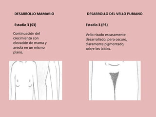 DESARROLLO MAMARIO DESARROLLO DEL VELLO PUBIANO 
Estadio 3 (S3) Estadio 3 (P3) 
Continuación del 
crecimiento con 
elevación de mama y 
areola en un mismo 
plano. 
Vello rizado escasamente 
desarrollado, pero oscuro, 
claramente pigmentado, 
sobre los labios. 
 