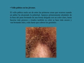 • Vello púbico en los jóvenes. 
El vello púbico suele ser de entre las primeras cosas que ocurren cuando 
un púber ha alcanzado la pubertad. Aparece primeramente alrededor de 
la base del pene brotando de una forma delgada con un color claro, hasta 
hacerse más gruesos y rizados también su color se hace más oscuro y 
van brotando más y más hasta que cubren los genitales. 
 