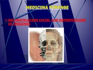  RECONSTRUCCION FACIAL CON SUPERPOSICION
  DE IMÁGENES
 