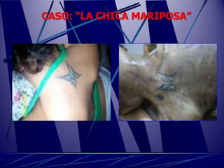 CASO: “LA CHICA MARIPOSA”
 