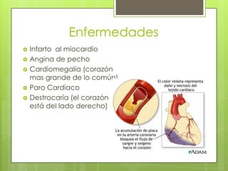 Enfermedades






Infarto al miocardio
Angina de pecho
Cardiomegalia (corazón
mas grande de lo común)
Paro Cardiaco
Destrocaría (el corazón
está del lado derecho)

 