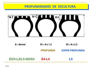 MSM
PROFUNDIDADES DE ESCULTURA
PROFUNDA
E2/3-L2/L3-G2/G3 E4-L4 L5
SUPER PROFUNDA
 
