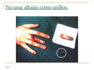 MSM
No usar alhajas como anillos.
 
