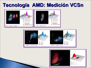Tecnología AMD: Medición VCSn
 
