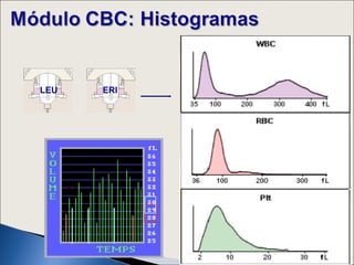 ALTO
LEU   ERI
                   ANCHO
 