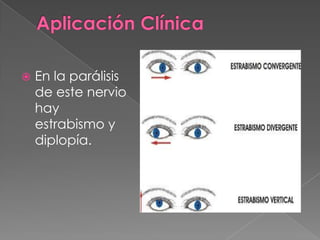    En la parálisis
    de este nervio
    hay
    estrabismo y
    diplopía.
 
