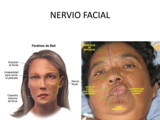 NERVIO FACIAL
 