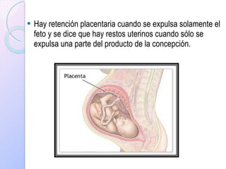 Hay retención placentaria cuando se expulsa solamente el feto y se dice que hay restos uterinos cuando sólo se expulsa una parte del producto de la concepción.   