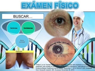 BUSCAR…
Arco
corneal
Watts G, et al. Familial hypercholesterolaemia: A review with emphasis on evidence for
treatment, new models of care and health economic evaluations. International Journal Of
Evidence-Based Healthcare [serial online]. September 1, 2012;10(3):211-221. Available
from: Scopus®, Ipswich, MA. Accessed November 20, 2013
 