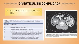 ---------- DIVERTICULITIS COMPLICADA ----------
● Absceso: Abdomen doloroso, masa dolorosa y
fiebre
 