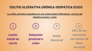 COLITIS ULCERATIVA CRÓNICA IDIOPÁTICA (CUCI)
La colitis ulcerativa idiopática es una enfermedad inflamatoria crónica del
intestino grueso y recto
Extensión
proximal a
colón
2
Unión
ileocecal
3
20% de los
pacientes
con lesión de
íleon
terminal
4
1
Lesión
inicial en
recrto
 