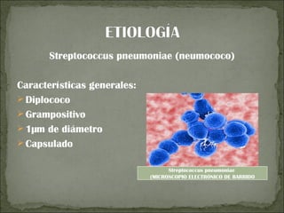 Streptococcus pneumoniae (neumococo)

Características generales:
 Diplococo
 Grampositivo
 1µm de diámetro
 Capsulado


                                   Streptococcus pneumoniae
                             (MICROSCOPIO ELECTRÓNICO DE BARRIDO
 