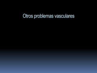 Otros problemas vasculares
 