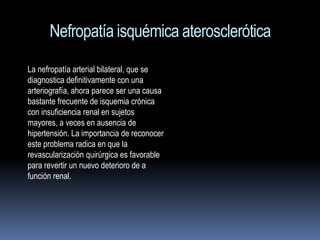 Nefropatía isquémica aterosclerótica
La nefropatía arterial bilateral, que se
diagnostica definitivamente con una
arteriografía, ahora parece ser una causa
bastante frecuente de isquemia crónica
con insuficiencia renal en sujetos
mayores, a veces en ausencia de
hipertensión. La importancia de reconocer
este problema radica en que la
revascularización quirúrgica es favorable
para revertir un nuevo deterioro de a
función renal.
 