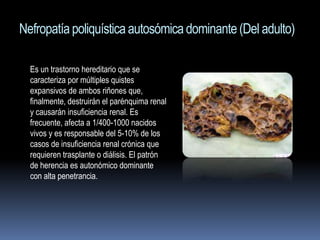 Nefropatía poliquística autosómica dominante (Del adulto)

  Es un trastorno hereditario que se
  caracteriza por múltiples quistes
  expansivos de ambos riñones que,
  finalmente, destruirán el parénquima renal
  y causarán insuficiencia renal. Es
  frecuente, afecta a 1/400-1000 nacidos
  vivos y es responsable del 5-10% de los
  casos de insuficiencia renal crónica que
  requieren trasplante o diálisis. El patrón
  de herencia es autonómico dominante
  con alta penetrancia.
 