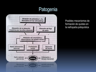 Patogenia
            Posibles mecanismos de
            formación de quistes en
            la nefropatía poliquística
 