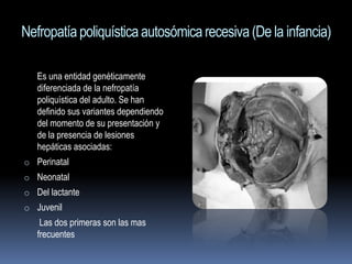 Nefropatía poliquística autosómica recesiva (De la infancia)

   Es una entidad genéticamente
   diferenciada de la nefropatía
   poliquística del adulto. Se han
   definido sus variantes dependiendo
   del momento de su presentación y
   de la presencia de lesiones
   hepáticas asociadas:
o Perinatal
o Neonatal
o Del lactante
o Juvenil
    Las dos primeras son las mas
   frecuentes
 