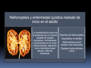 Nefronoptisis y enfermedad quística medular de
                inicio en el adulto

              La característica común es
              la presencia de un número Variantes de Nefronoptisis:
                   variable de quistes     Esporádica no familiar
               medulares, normalmente
               concentrados en la unión     Nefronoptisis juvenil
               corticomedular, alteración familiar (mas frecuente)
                 de la membrana basal     Displasia renal-retiniana
                    tubular y fibrosis              (15%)
                       intersticial.
 