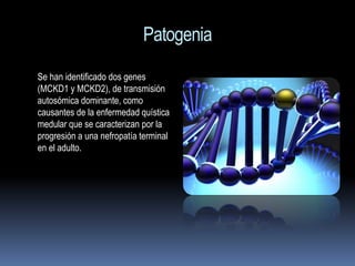 Patogenia
Se han identificado dos genes
(MCKD1 y MCKD2), de transmisión
autosómica dominante, como
causantes de la enfermedad quística
medular que se caracterizan por la
progresión a una nefropatía terminal
en el adulto.
 